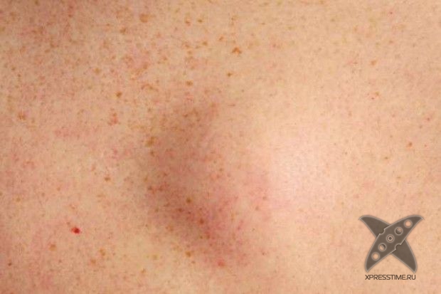 Отвратительные вещи в человеческом теле