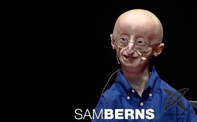 В США 17-летний подросток умер от старости