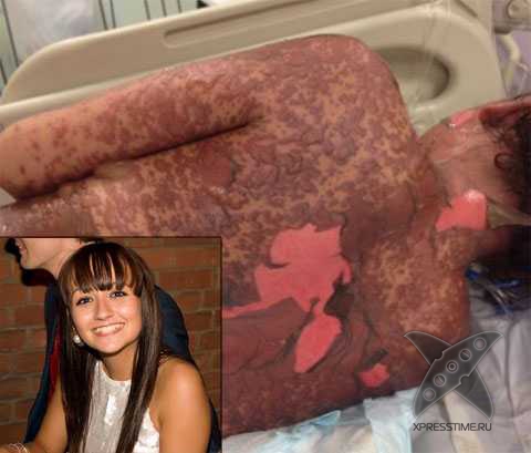 Девушка отравилась безобидными таблетками