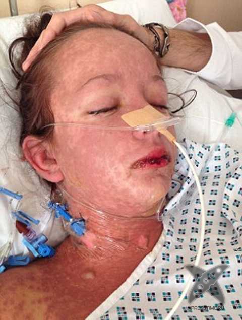 Девушка отравилась безобидными таблетками