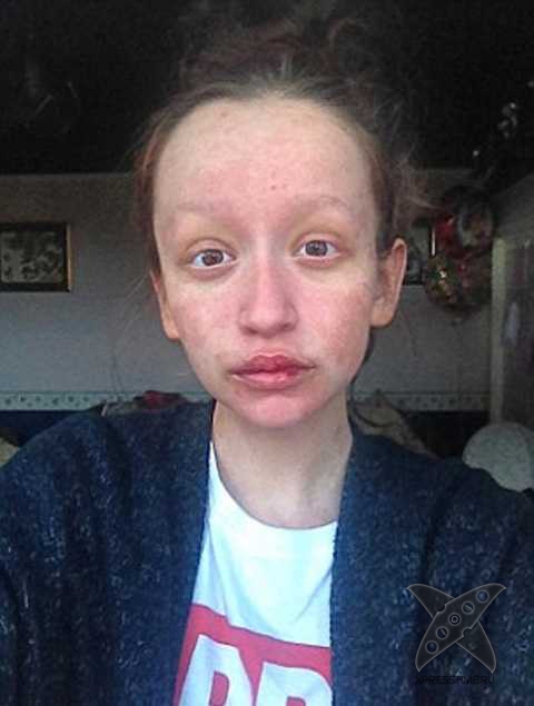 Девушка отравилась безобидными таблетками