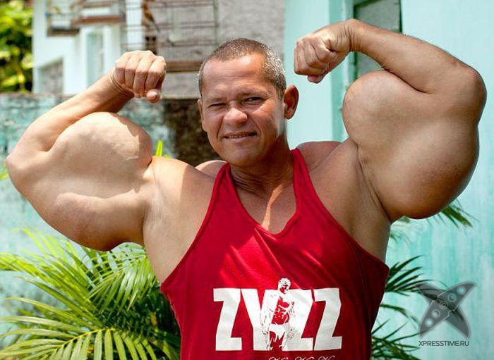 Очередная жертва синтола