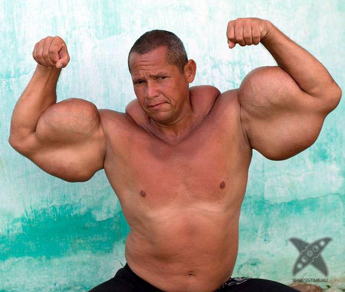 Очередная жертва синтола