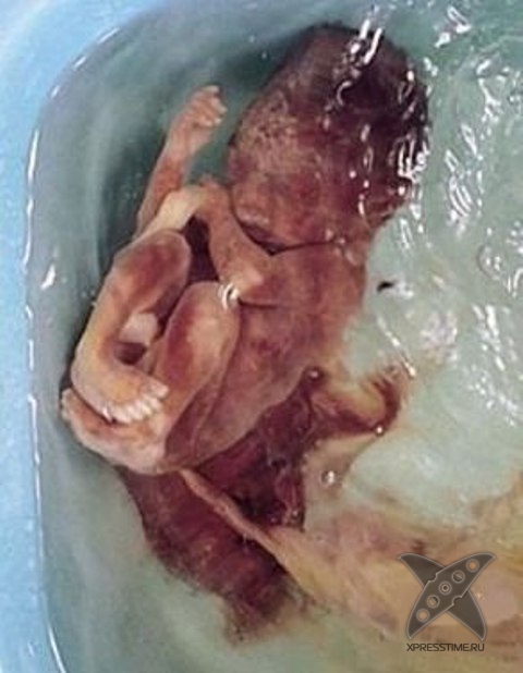 Китай - страна людоедов