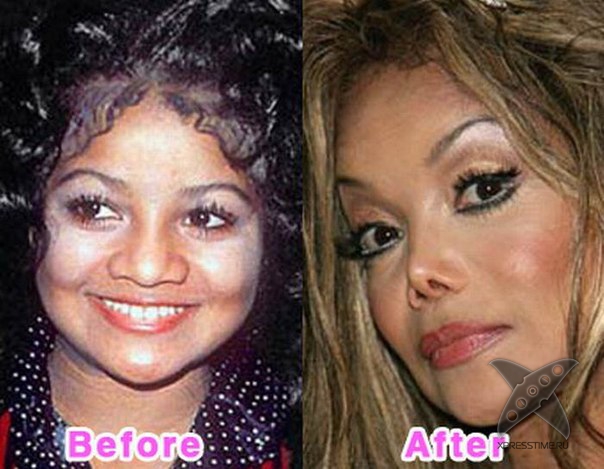 Неудачные последствия пластической хирургии