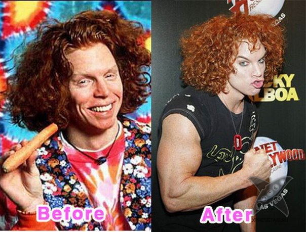 Неудачные последствия пластической хирургии