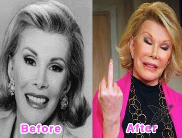 Неудачные последствия пластической хирургии