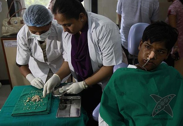Во рту индийского подростка обнаружили 232 зуба