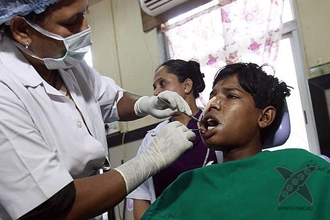 Во рту индийского подростка обнаружили 232 зуба