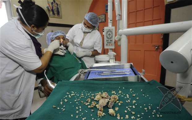 Во рту индийского подростка обнаружили 232 зуба