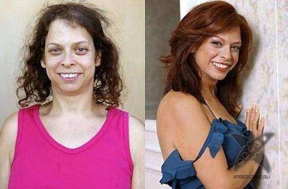 Чудеса пластики и косметики