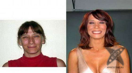 Чудеса пластики и косметики