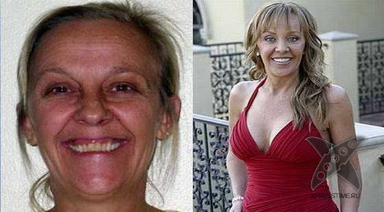 Чудеса пластики и косметики