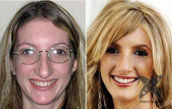 Чудеса пластики и косметики