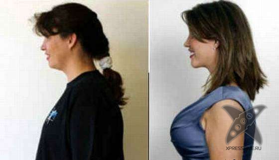 Чудеса пластики и косметики