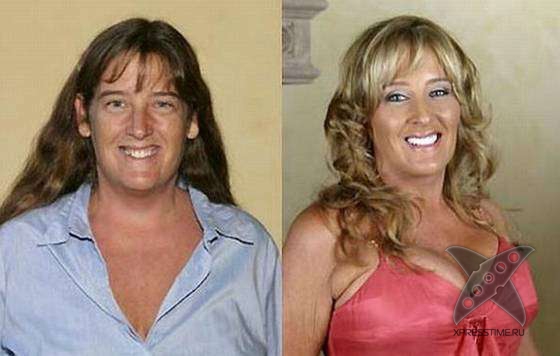 Чудеса пластики и косметики