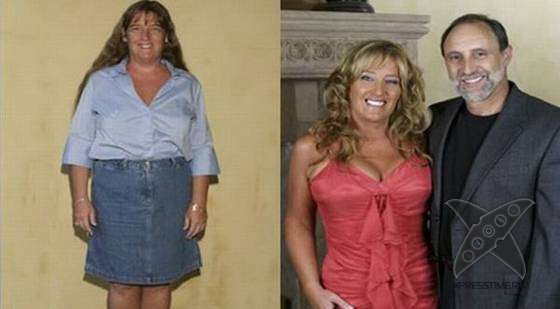 Чудеса пластики и косметики