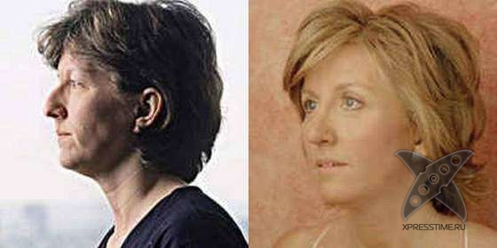 Чудеса пластики и косметики