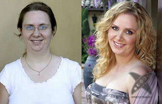 Чудеса пластики и косметики