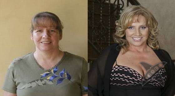 Чудеса пластики и косметики