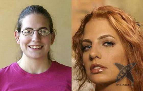 Чудеса пластики и косметики