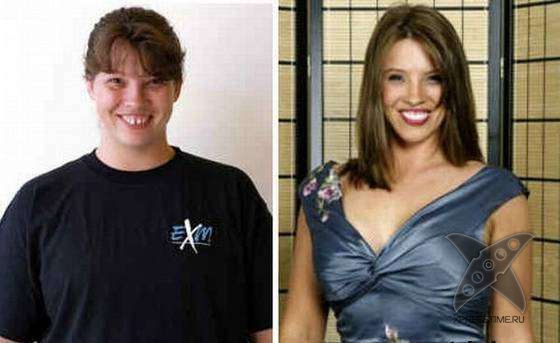 Чудеса пластики и косметики