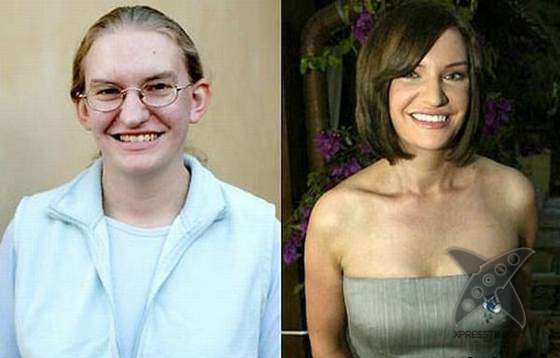 Чудеса пластики и косметики