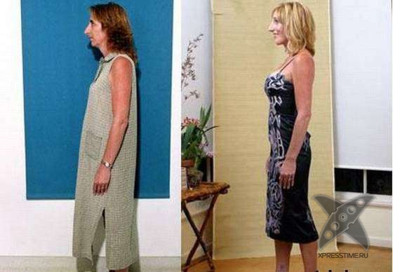 Чудеса пластики и косметики