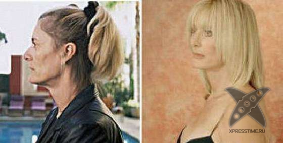 Чудеса пластики и косметики