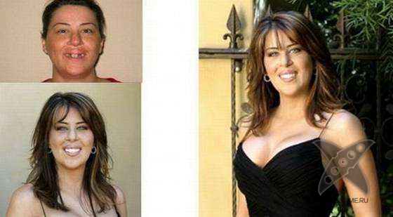 Чудеса пластики и косметики