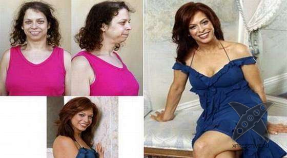 Чудеса пластики и косметики