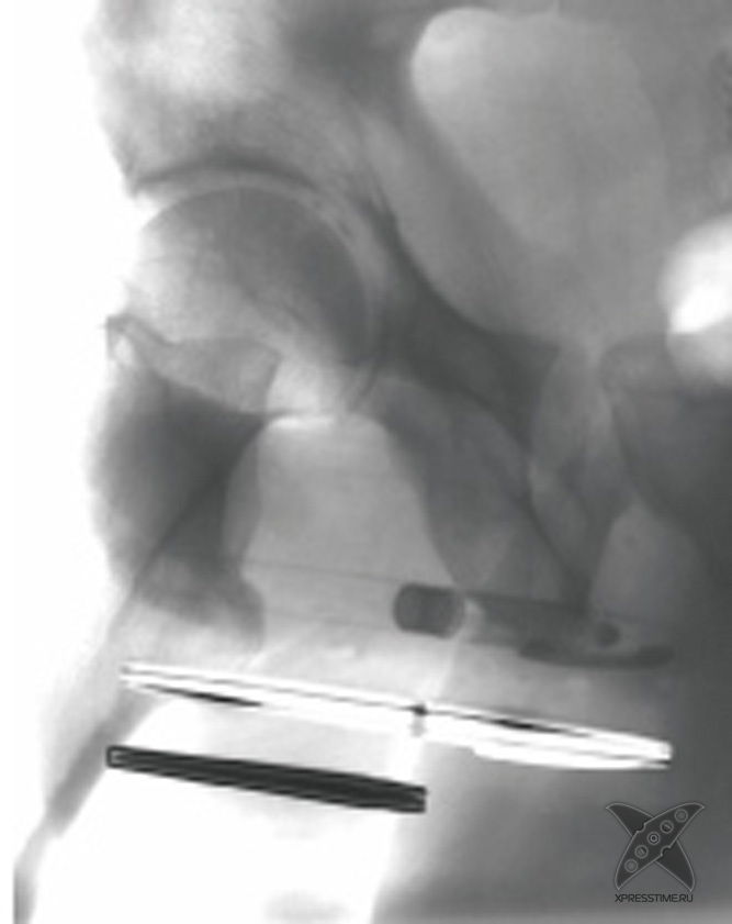 Странные предметы из тел пациентов