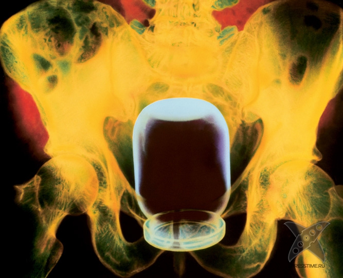 Странные предметы из тел пациентов