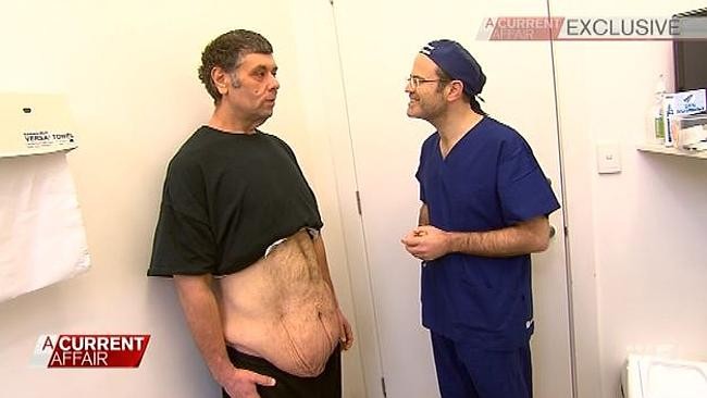 Мужчина сбросил 200 кг-4