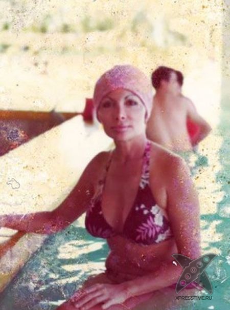 Жертва пластической хирургии Эльза Паттон