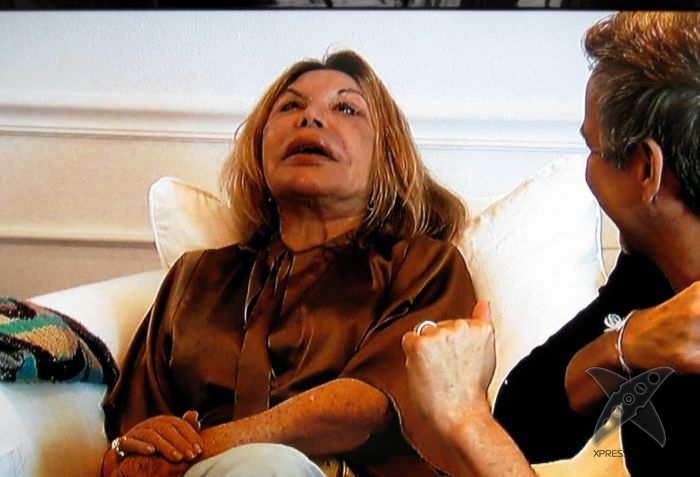 Жертва пластической хирургии Эльза Паттон