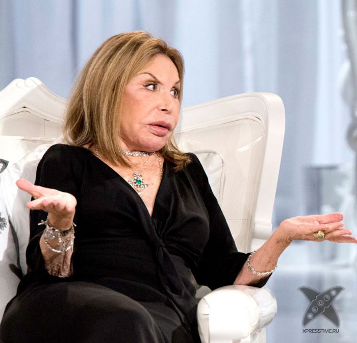 Жертва пластической хирургии Эльза Паттон