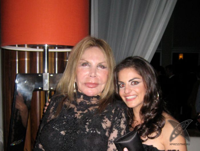 Жертва пластической хирургии Эльза Паттон