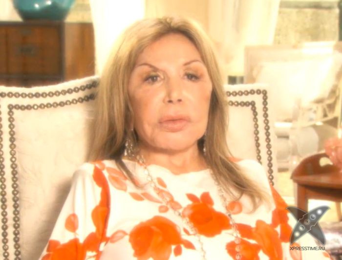 Жертва пластической хирургии Эльза Паттон