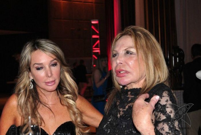 Жертва пластической хирургии Эльза Паттон