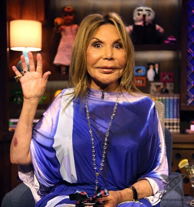 Жертва пластической хирургии Эльза Паттон