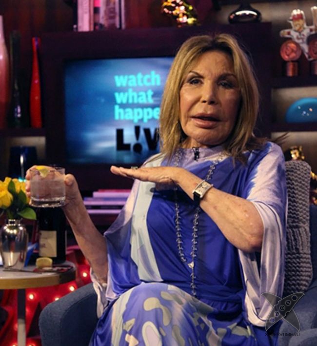 Жертва пластической хирургии Эльза Паттон