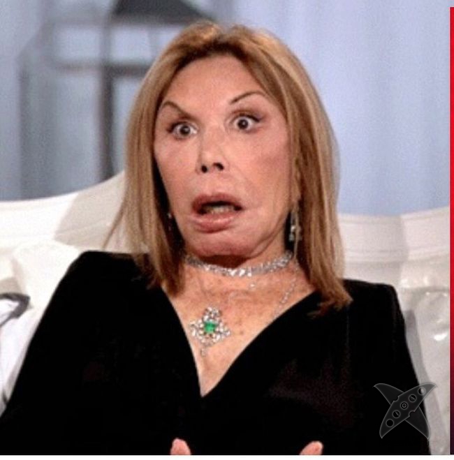 Жертва пластической хирургии Эльза Паттон