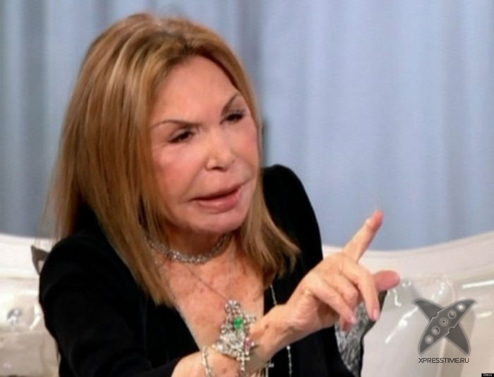 Жертва пластической хирургии Эльза Паттон