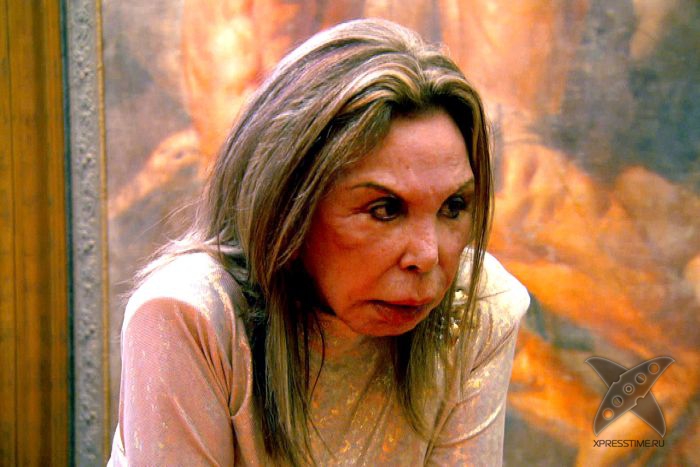 Жертва пластической хирургии Эльза Паттон