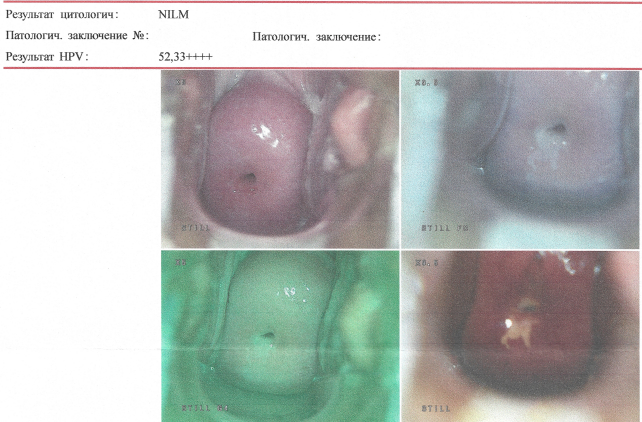 моя влагалищна изнутри