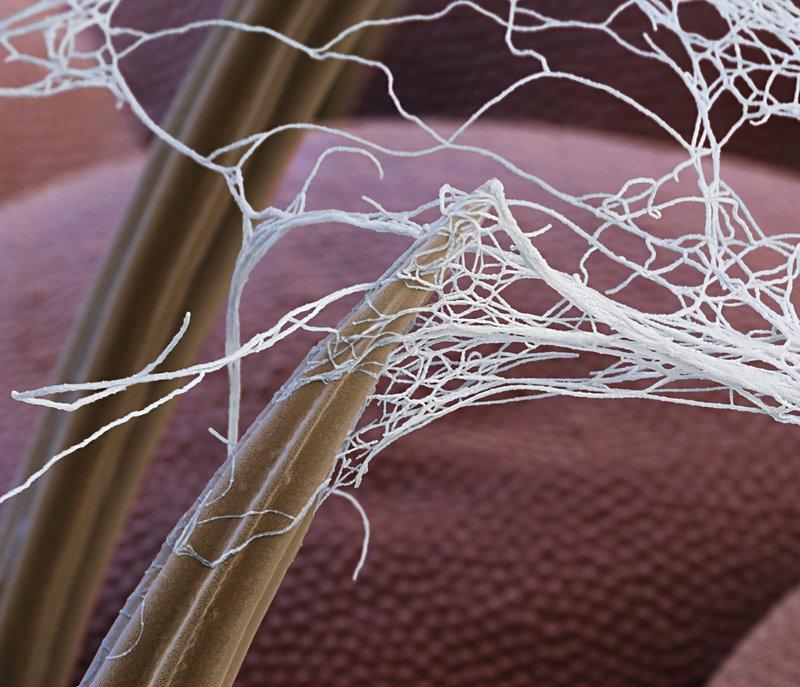 Муха, оплетённая паутиной. Увеличение: x12 000. Электронный микроскоп.