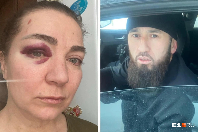 Неизвестные избили екатеринбурженку на Сортировке Источник: читатель E1.RU