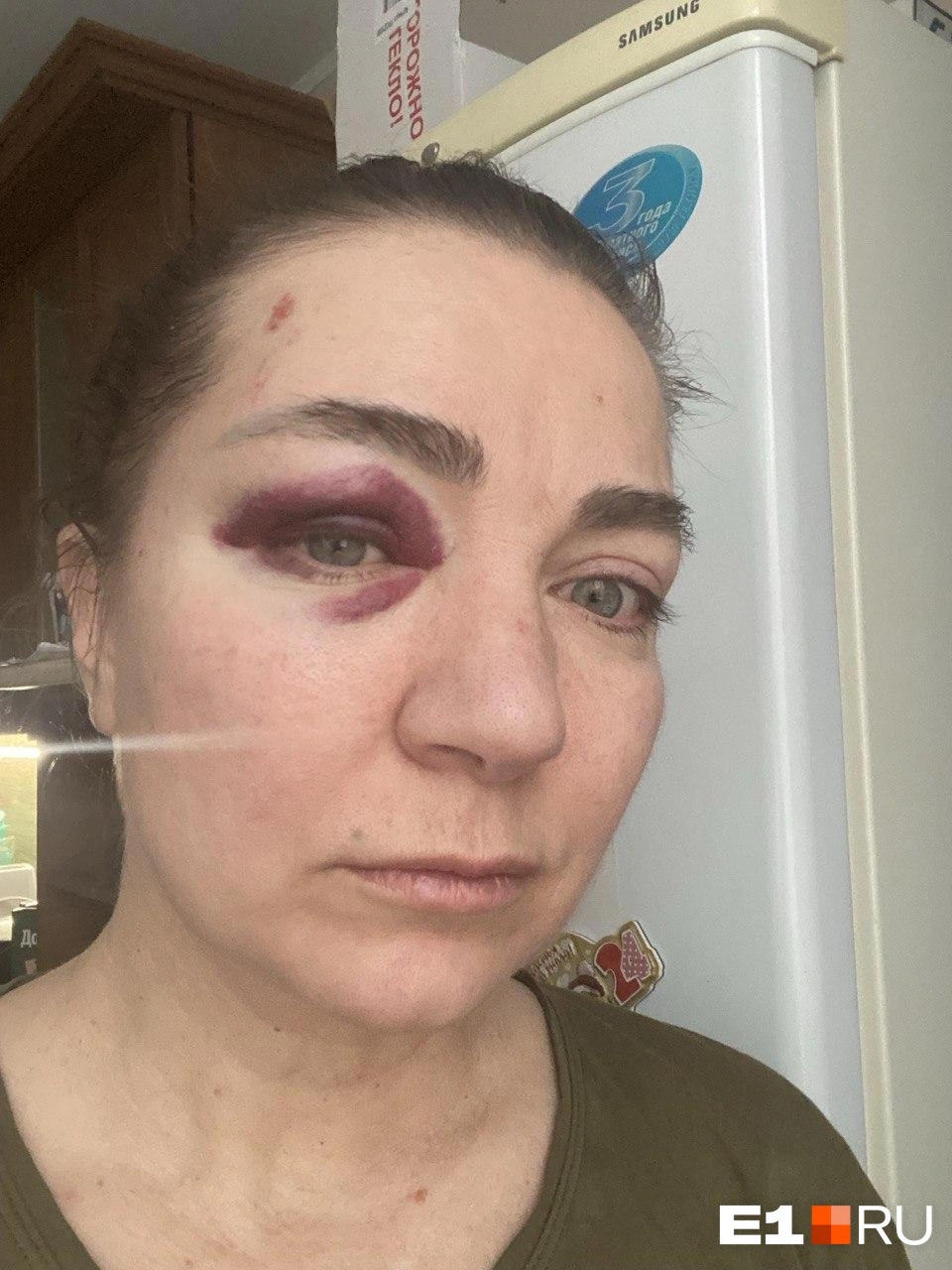 Наталья получила сильные повреждения Источник: читатель E1.RU